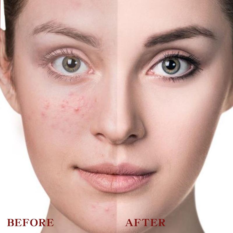 High Quality Private Label Vegetarian Full Coverage Waterproof Concealer Liquid Custom HD Concealer